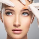 Facial areas indicated for Botox injections