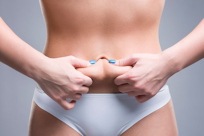 Abdominoplasty Procedure Detroit