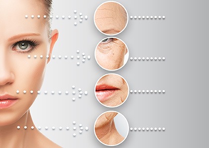 Dermal Fillers