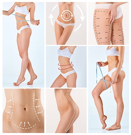 Body parts that can undergo liposuction